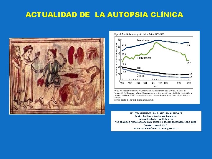 ACTUALIDAD DE LA AUTOPSIA CLÍNICA U. S. DEPARTMENT OF HEALTH AND HUMAN SERVICES Centers