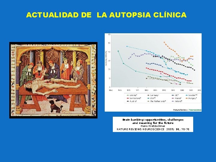 ACTUALIDAD DE LA AUTOPSIA CLÍNICA Brain banking: opportunities, challenges and meaning for the future