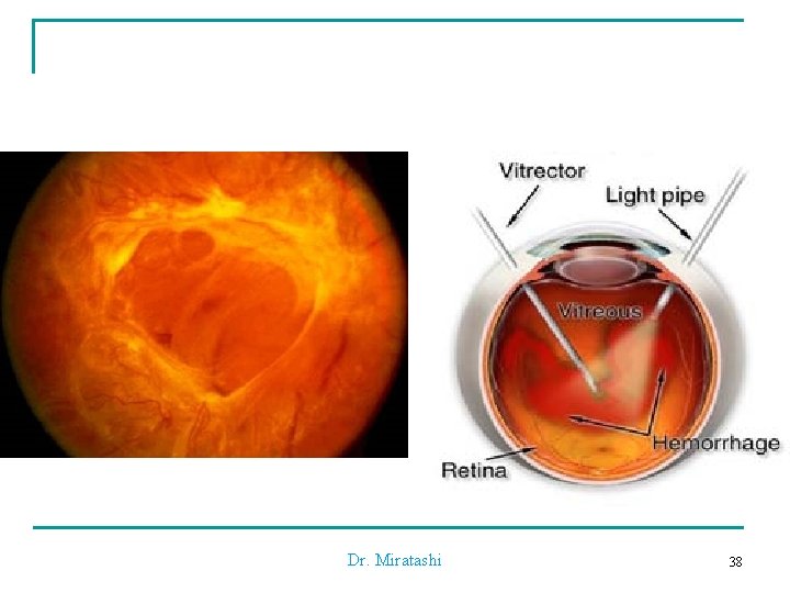 Dr. Miratashi 38 