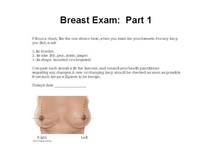 Breast Exam: Part 1 