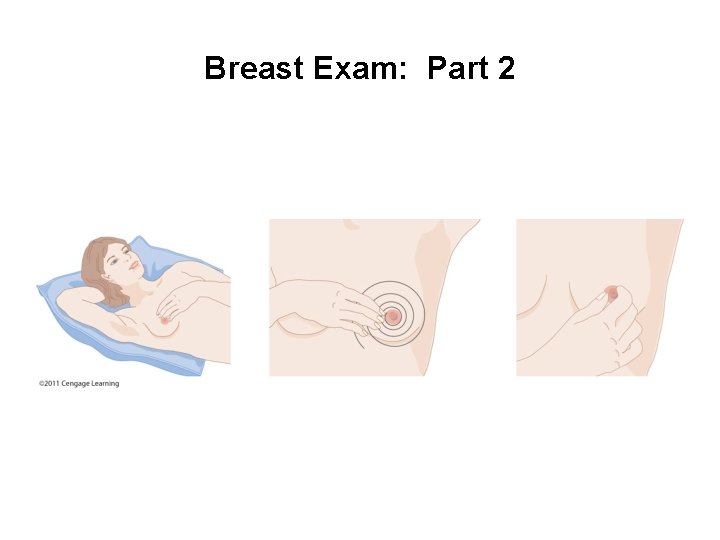Breast Exam: Part 2 