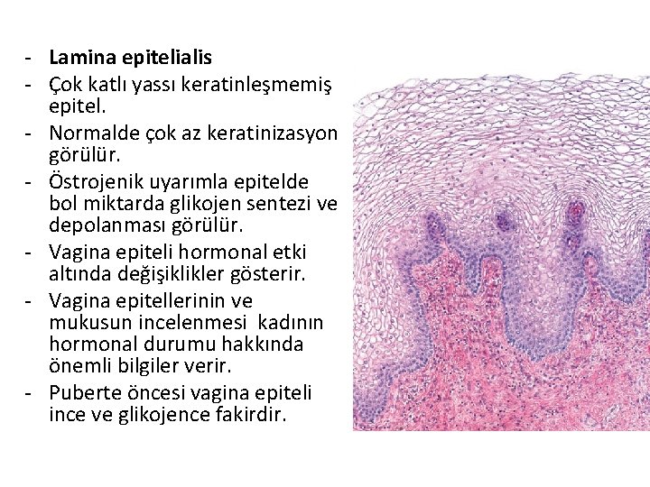 - Lamina epitelialis - Çok katlı yassı keratinleşmemiş epitel. - Normalde çok az keratinizasyon