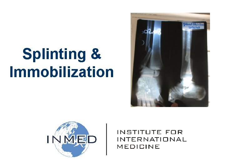 Splinting & Immobilization 