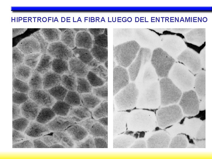 HIPERTROFIA DE LA FIBRA LUEGO DEL ENTRENAMIENO 