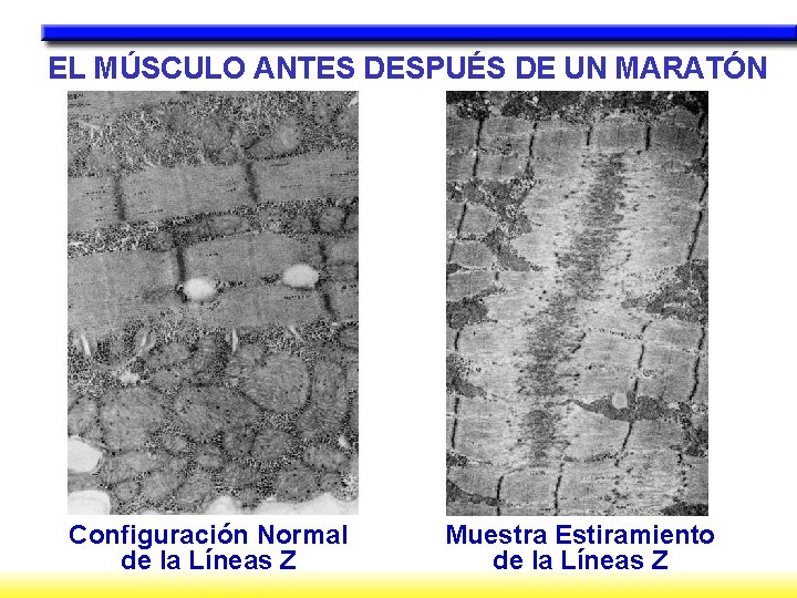 EL MÚSCULO ANTES DESPUÉS DE UN MARATÓN Configuración Normal de la Líneas Z Muestra