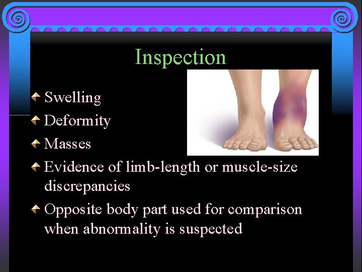 Inspection Swelling Deformity Masses Evidence of limb-length or muscle-size discrepancies Opposite body part used