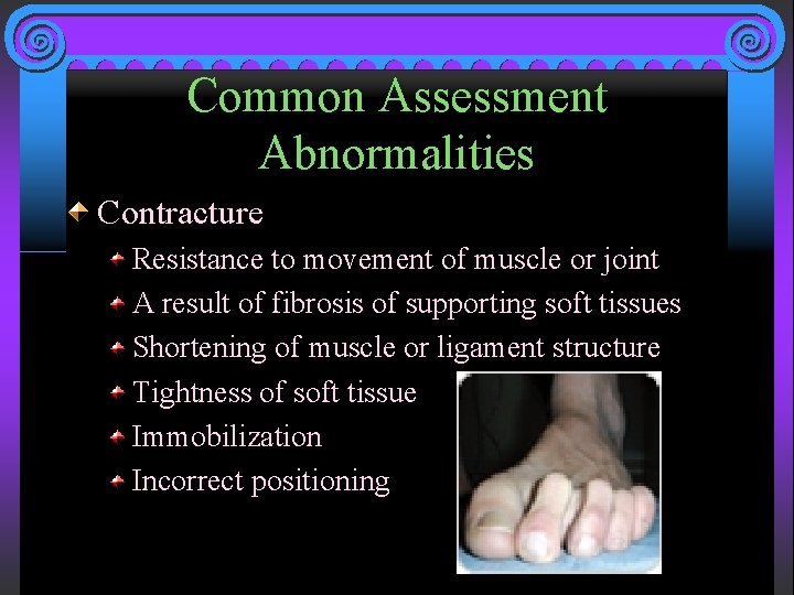 Common Assessment Abnormalities Contracture Resistance to movement of muscle or joint A result of