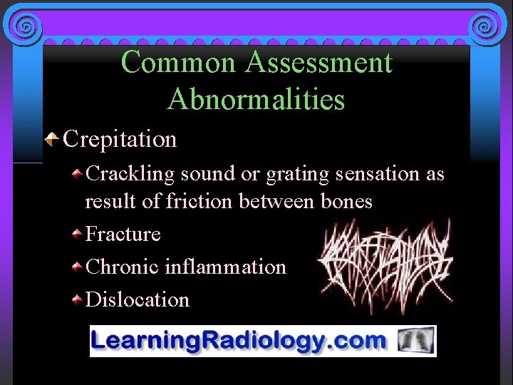 Common Assessment Abnormalities Crepitation Crackling sound or grating sensation as result of friction between