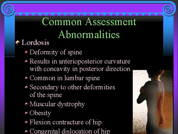 Common Assessment Abnormalities Lordosis Deformity of spine Results in anterioposterior curvature with concavity in