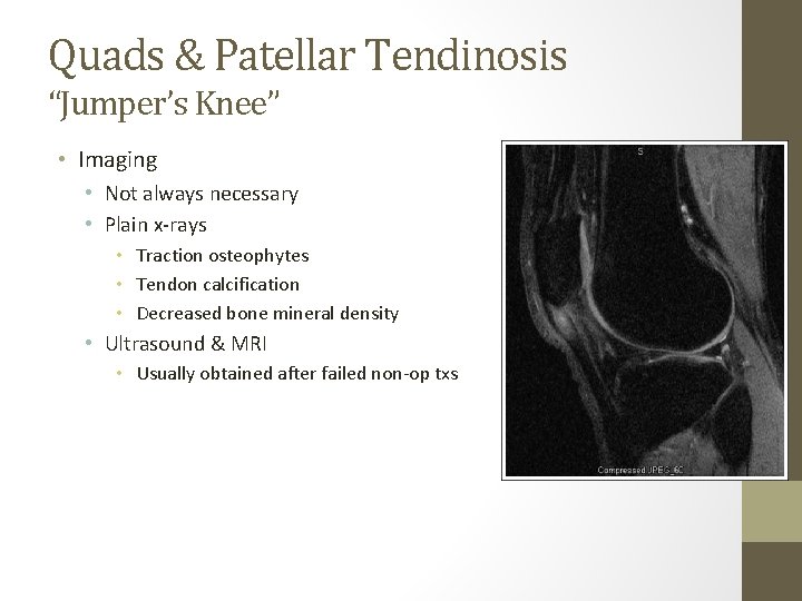 Quads & Patellar Tendinosis “Jumper’s Knee” • Imaging • Not always necessary • Plain Quads & Patellar Tendinosis “Jumper’s Knee” • Imaging • Not always necessary • Plain