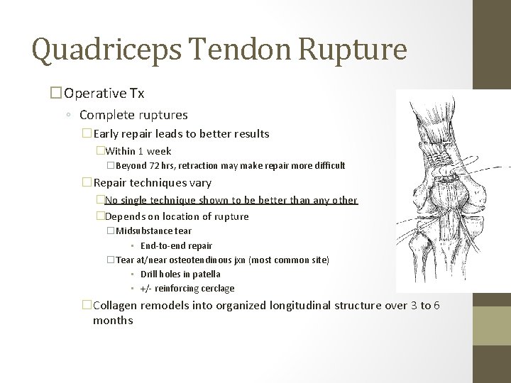 Quadriceps Tendon Rupture �Operative Tx ◦ Complete ruptures �Early repair leads to better results Quadriceps Tendon Rupture �Operative Tx ◦ Complete ruptures �Early repair leads to better results