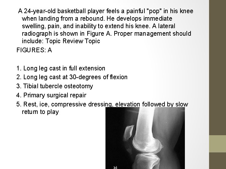 A 24 -year-old basketball player feels a painful "pop" in his knee when landing A 24 -year-old basketball player feels a painful "pop" in his knee when landing