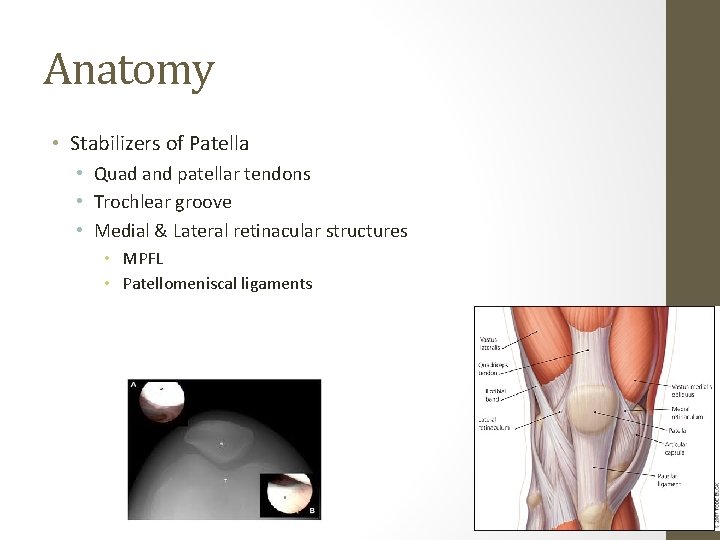 Anatomy • Stabilizers of Patella • Quad and patellar tendons • Trochlear groove • Anatomy • Stabilizers of Patella • Quad and patellar tendons • Trochlear groove •