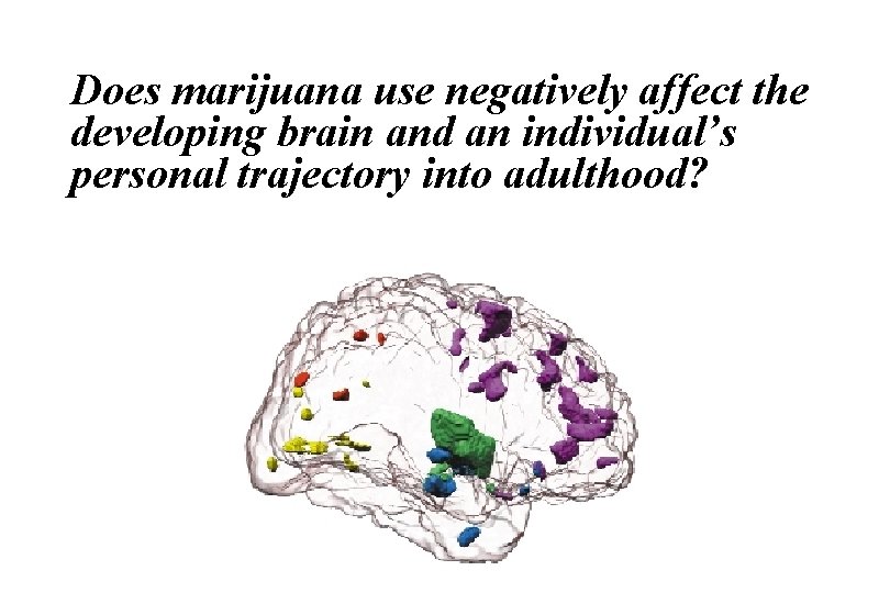 Does marijuana use negatively affect the developing brain and an individual’s personal trajectory into