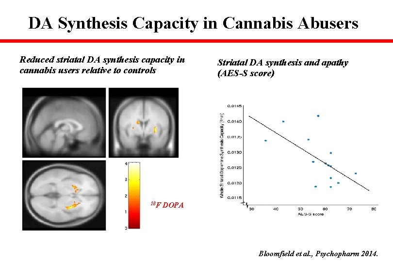DA Synthesis Capacity in Cannabis Abusers Reduced striatal DA synthesis capacity in cannabis users