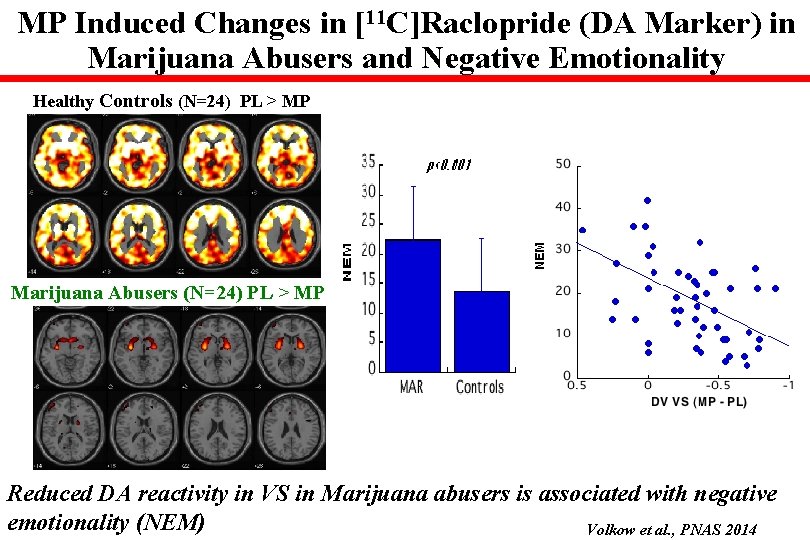 MP Induced Changes in [11 C]Raclopride (DA Marker) in Marijuana Abusers and Negative Emotionality