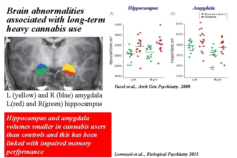 Brain abnormalities associated with long-term heavy cannabis use Hippocampus Amygdala Yucel et al. ,