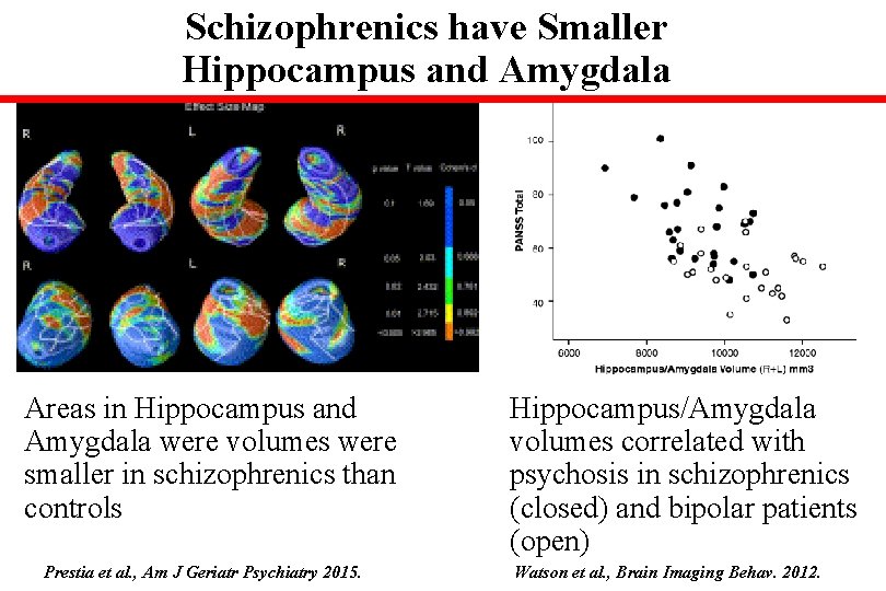 Schizophrenics have Smaller Hippocampus and Amygdala Areas in Hippocampus and Amygdala were volumes were