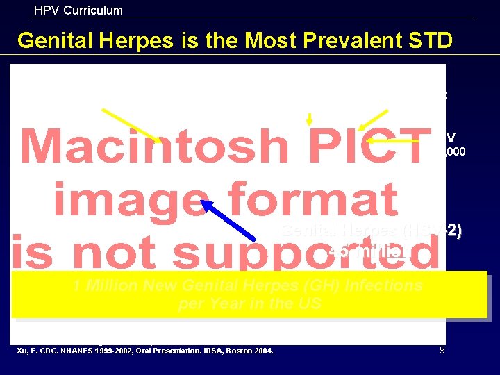 HPV Curriculum Genital Herpes is the Most Prevalent STD HPV 20 million Chlamydia 2