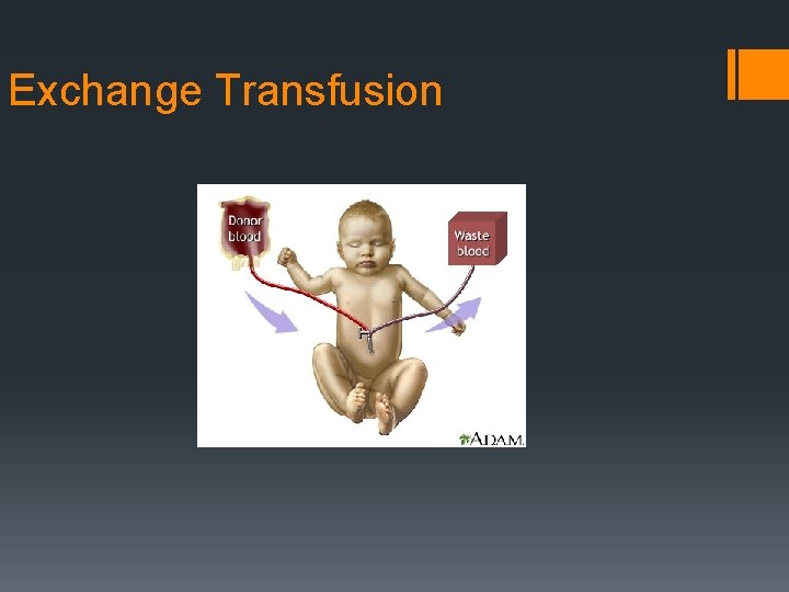Exchange Transfusion 