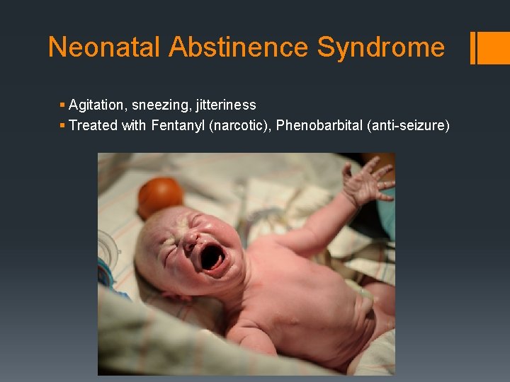 Neonatal Abstinence Syndrome § Agitation, sneezing, jitteriness § Treated with Fentanyl (narcotic), Phenobarbital (anti-seizure)