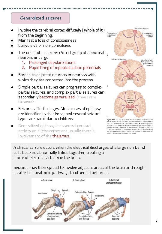 Epilepsy Overview Lecture 30 The Physiology Team Epilepsy Objectives Define