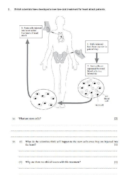 2. British scientists have developed a new low-cost treatment for heart attack patients. 