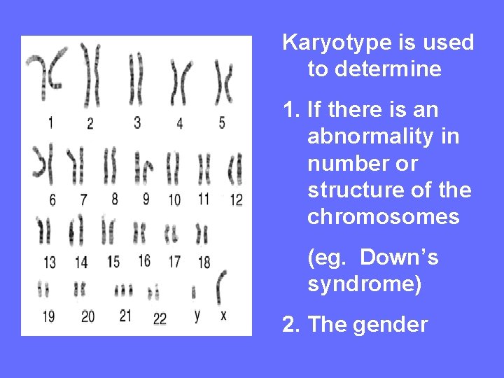 Karyotype is used to determine 1. If there is an abnormality in number or