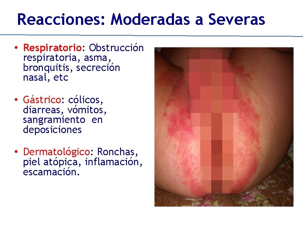 Reacciones: Moderadas a Severas • Respiratorio: Obstrucción respiratoria, asma, bronquitis, secreción nasal, etc •