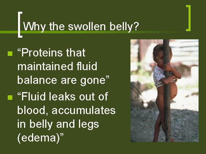 Why the swollen belly? n n “Proteins that maintained fluid balance are gone” “Fluid