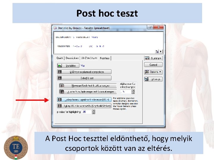 Post hoc teszt A Post Hoc teszttel eldönthető, hogy melyik csoportok között van az