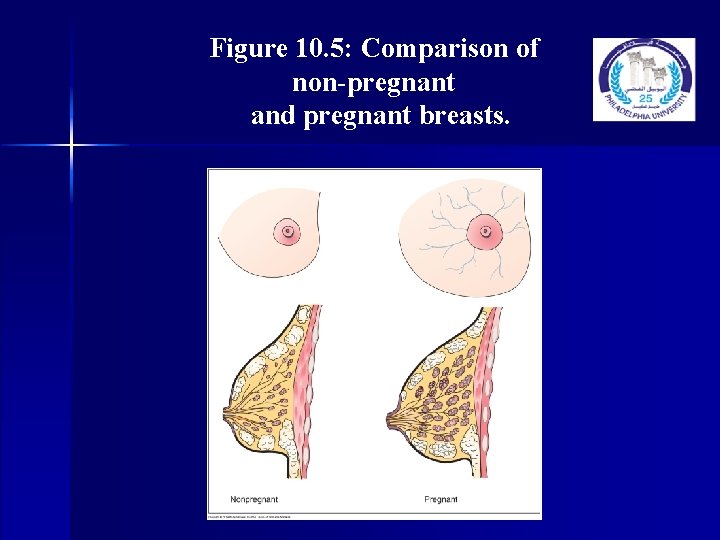 Figure 10. 5: Comparison of non-pregnant and pregnant breasts. 