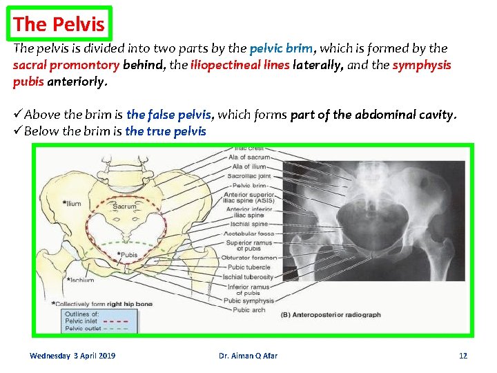 The Pelvis The pelvis is divided into two parts by the pelvic brim, which
