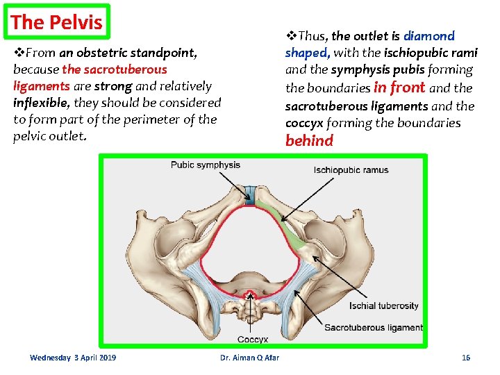 The Pelvis v. From an obstetric standpoint, because the sacrotuberous ligaments are strong and