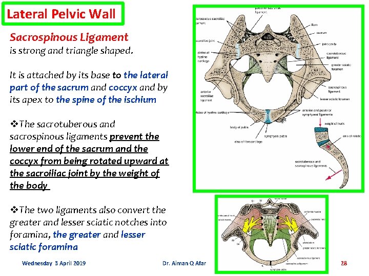 Lateral Pelvic Wall Sacrospinous Ligament is strong and triangle shaped. It is attached by