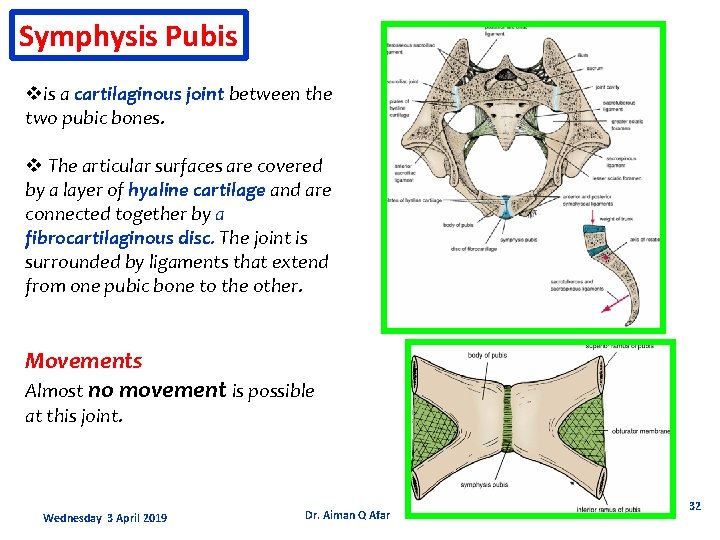Symphysis Pubis vis a cartilaginous joint between the two pubic bones. v The articular
