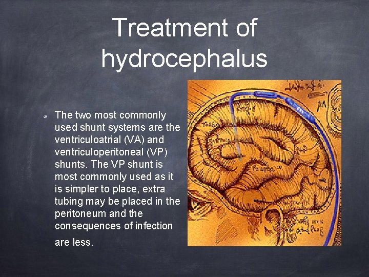Treatment of hydrocephalus The two most commonly used shunt systems are the ventriculoatrial (VA)