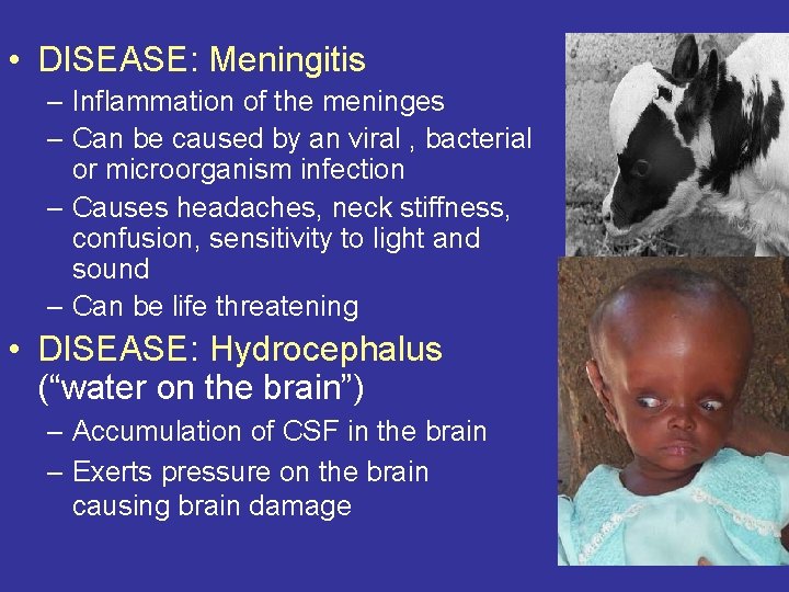  • DISEASE: Meningitis – Inflammation of the meninges – Can be caused by