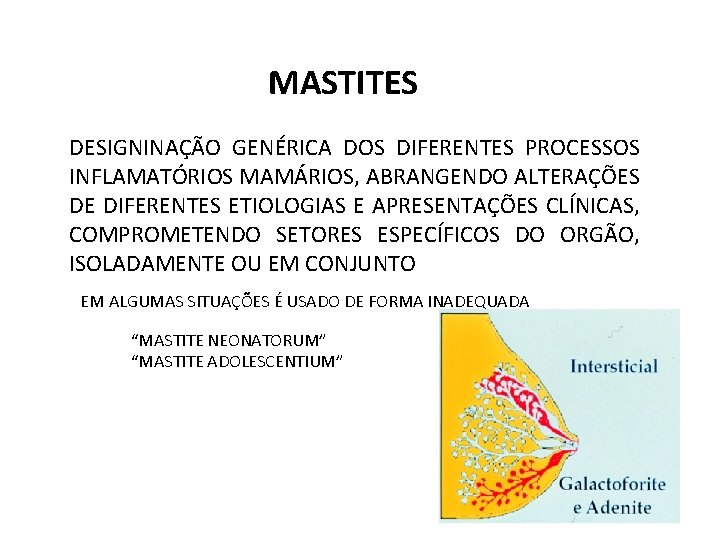 MASTITES DESIGNINAÇÃO GENÉRICA DOS DIFERENTES PROCESSOS INFLAMATÓRIOS MAMÁRIOS, ABRANGENDO ALTERAÇÕES DE DIFERENTES ETIOLOGIAS E