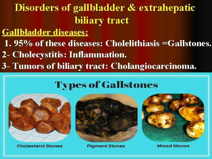 Disorders of gallbladder & extrahepatic biliary tract Gallbladder diseases: 1. 95% of these diseases: