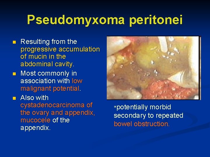 Pseudomyxoma peritonei n n n Resulting from the progressive accumulation of mucin in the