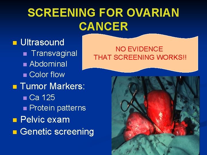 SCREENING FOR OVARIAN CANCER n Ultrasound Transvaginal n Abdominal n Color flow n n