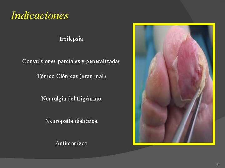 Indicaciones Epilepsia Convulsiones parciales y generalizadas Tónico Clónicas (gran mal) Neuralgia del trigémino. Neuropatía