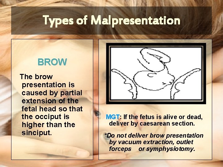 Types of Malpresentation BROW The brow presentation is caused by partial extension of the