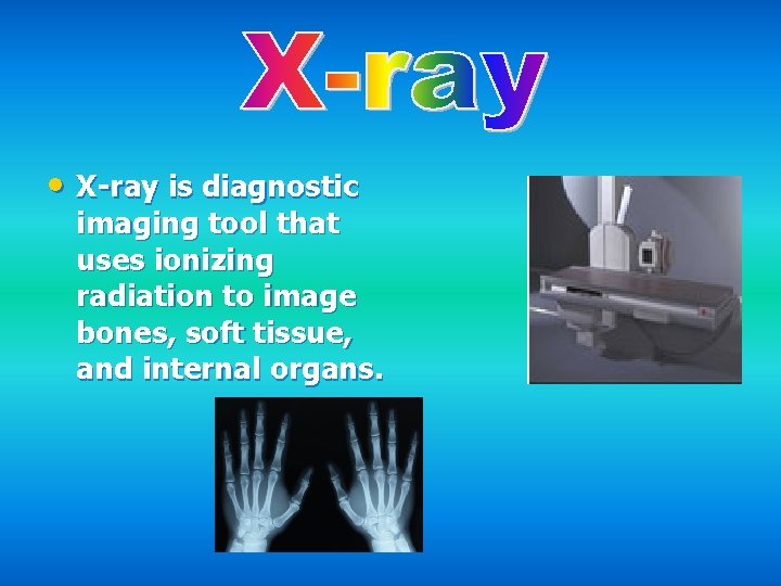  • X-ray is diagnostic imaging tool that uses ionizing radiation to image bones,