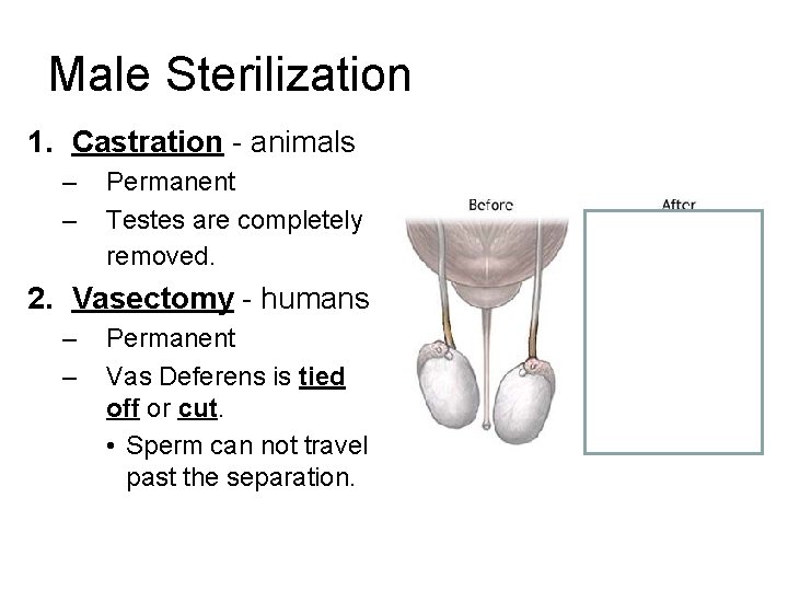 Male Sterilization 1. Castration - animals – – Permanent Testes are completely removed. 2.