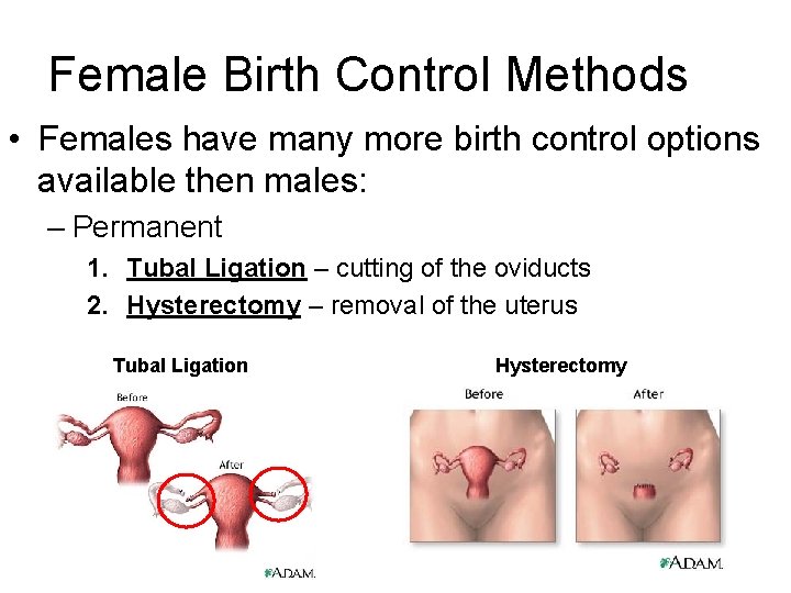 Female Birth Control Methods • Females have many more birth control options available then