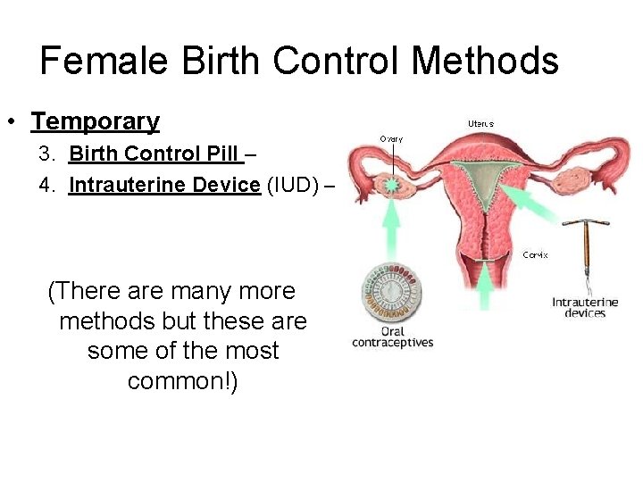 Female Birth Control Methods • Temporary 3. Birth Control Pill – 4. Intrauterine Device