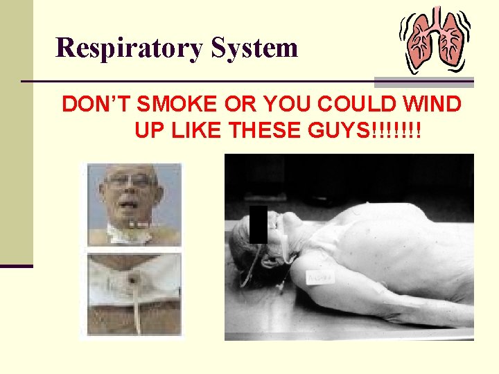 Respiratory System DON’T SMOKE OR YOU COULD WIND UP LIKE THESE GUYS!!!!!!! 