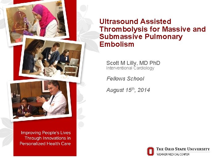 Ultrasound Assisted Thrombolysis for Massive and Submassive Pulmonary Embolism Scott M Lilly, MD Ph.